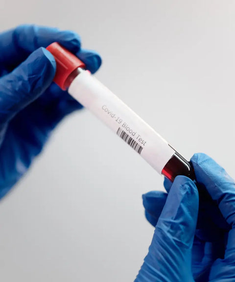 Gloved hands holding a vial labeled ‘Covid-19 Blood Test’ containing a blood sample, representing medical testing and diagnostic procedures in a laboratory setting